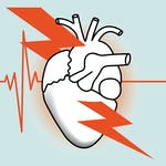 Myocardial Infarction by University of Zurich